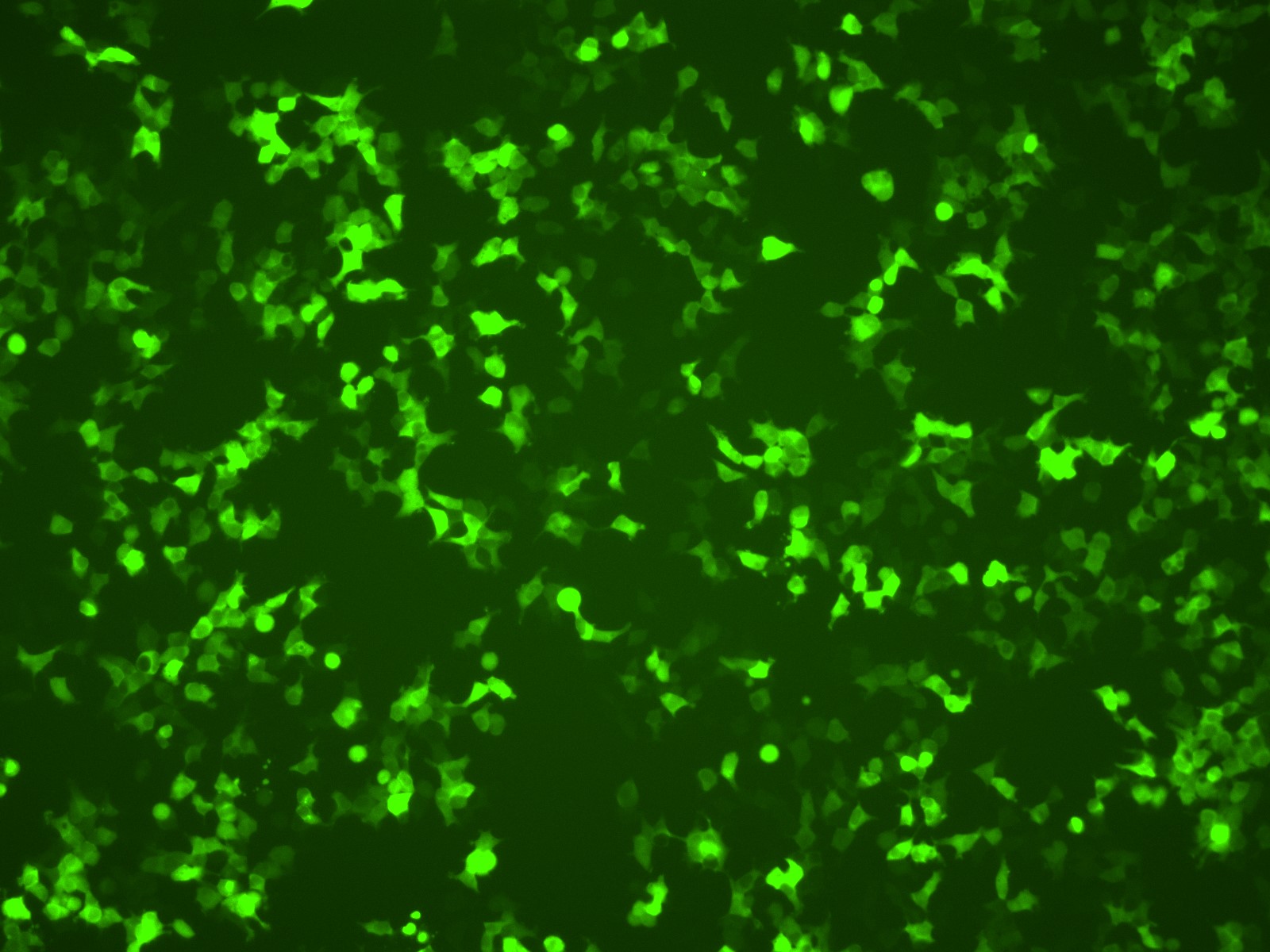 HEK 293T cells transfected with GFP-LUC