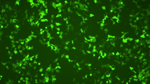 HEK 293T cells transfected with GFP-LUC